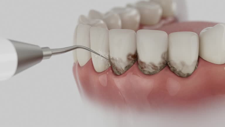 Reliable Dental contractor in Pendleton, IN by Dentist Open Now